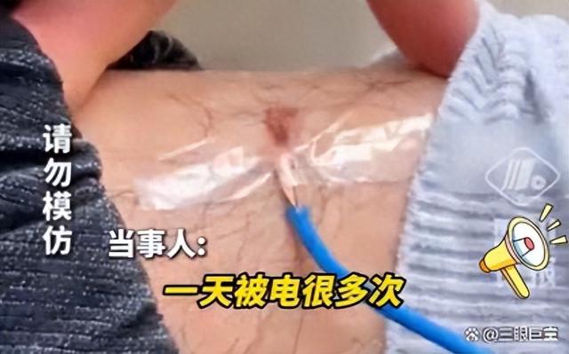 小伙为除静电出奇招，腿上接地线防被电