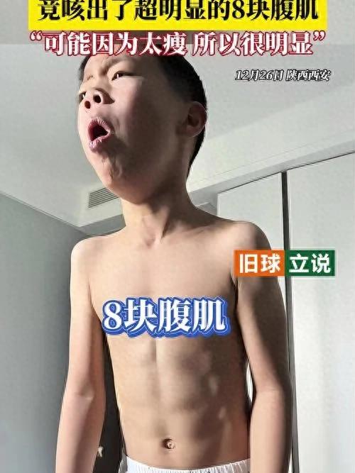 7岁男孩咳嗽10天，竟意外练出8块腹肌？